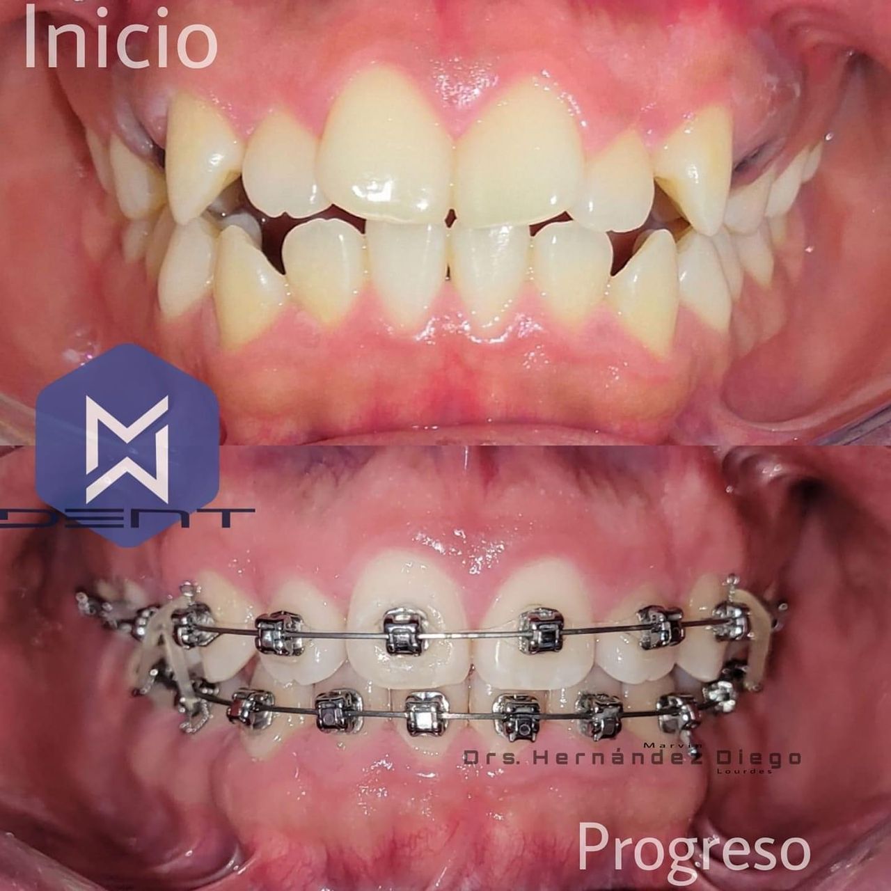 Marvin Adair Hernández Álvarez-31