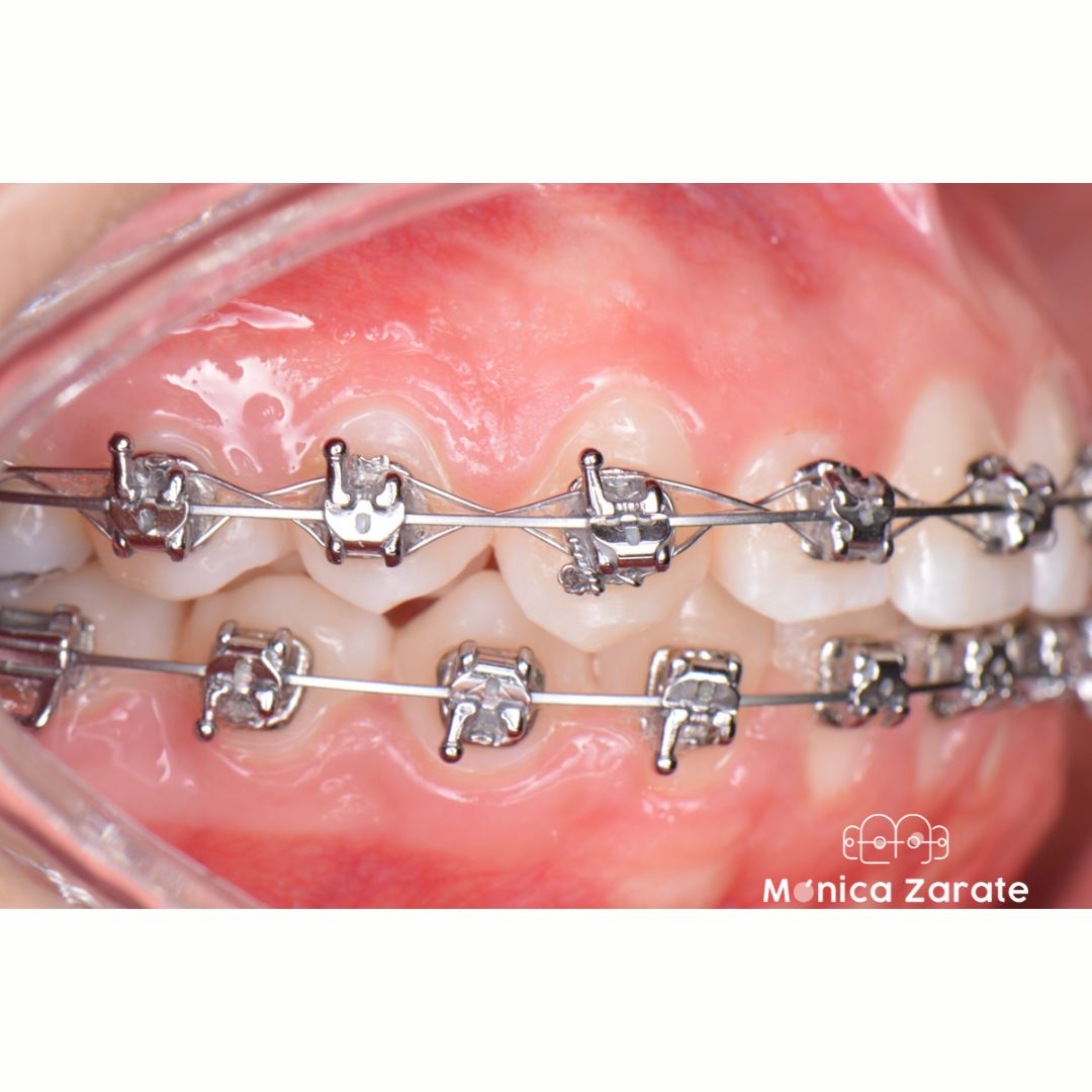 Mónica Isabel Zárate Pérez-18