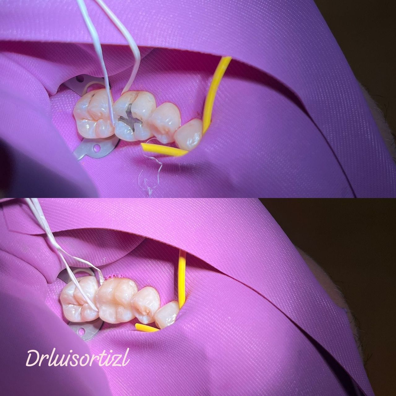 Luis Ángel Ortiz López-30