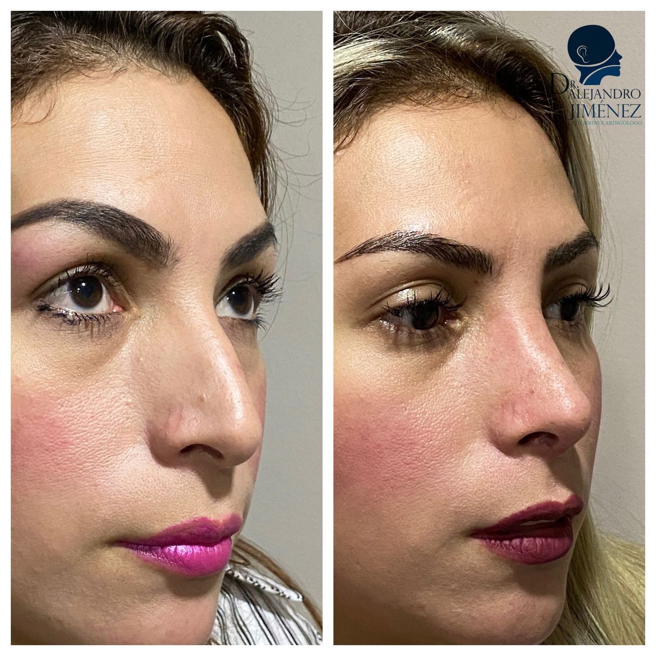 Alejandro Jimenez Garcia-19