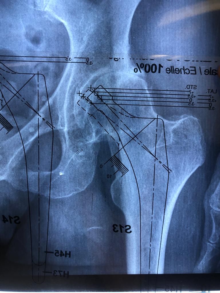 Aecio Madrigal Méndez-20