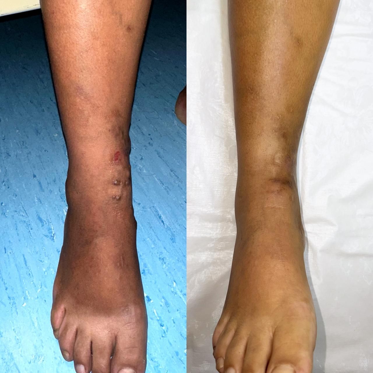 Jhonatan López González-13