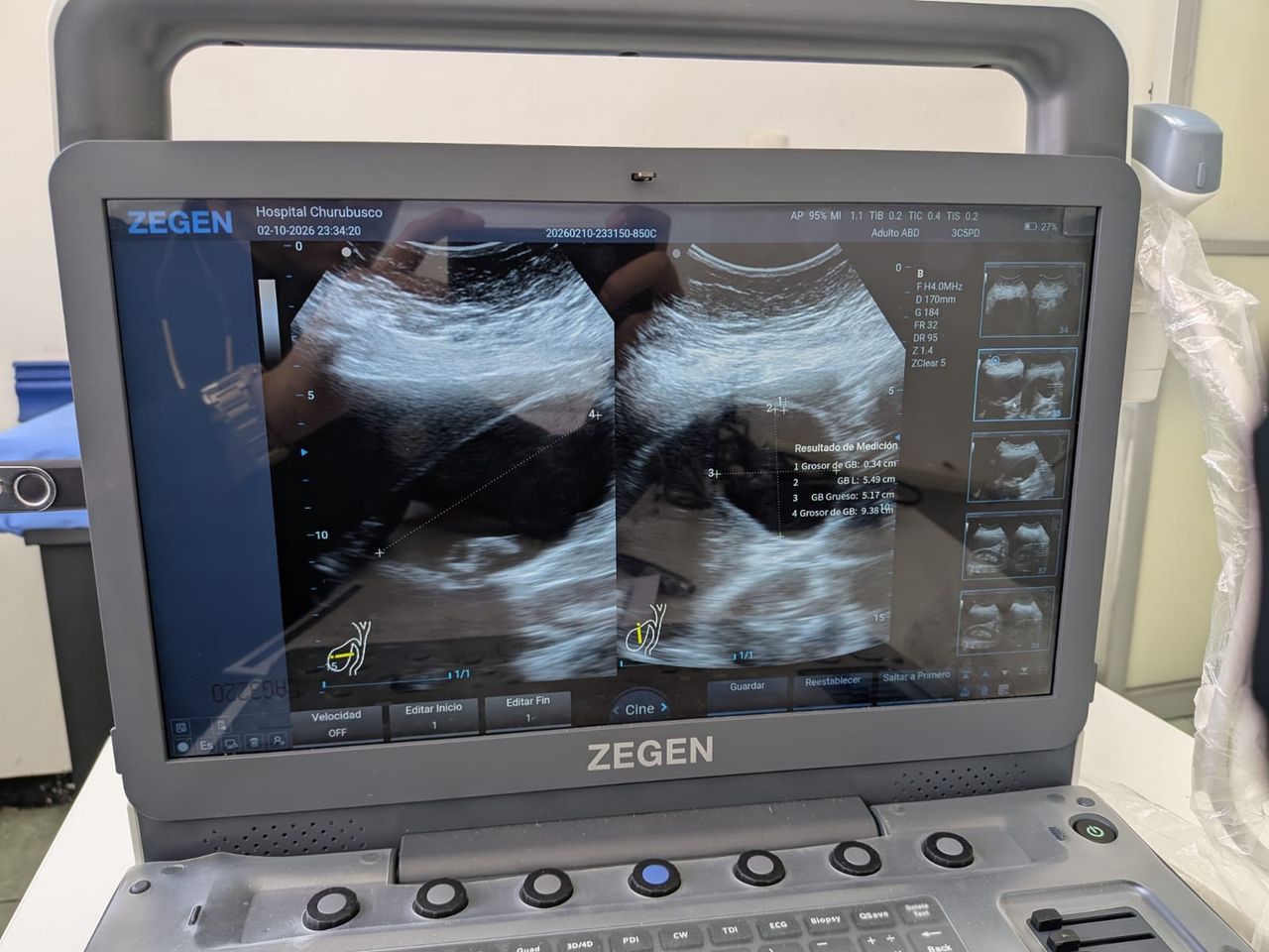 Jorg Augusto Striebel Gonzalez-2