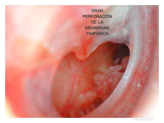 Nuria Esperanza Boronat Echeverria-14