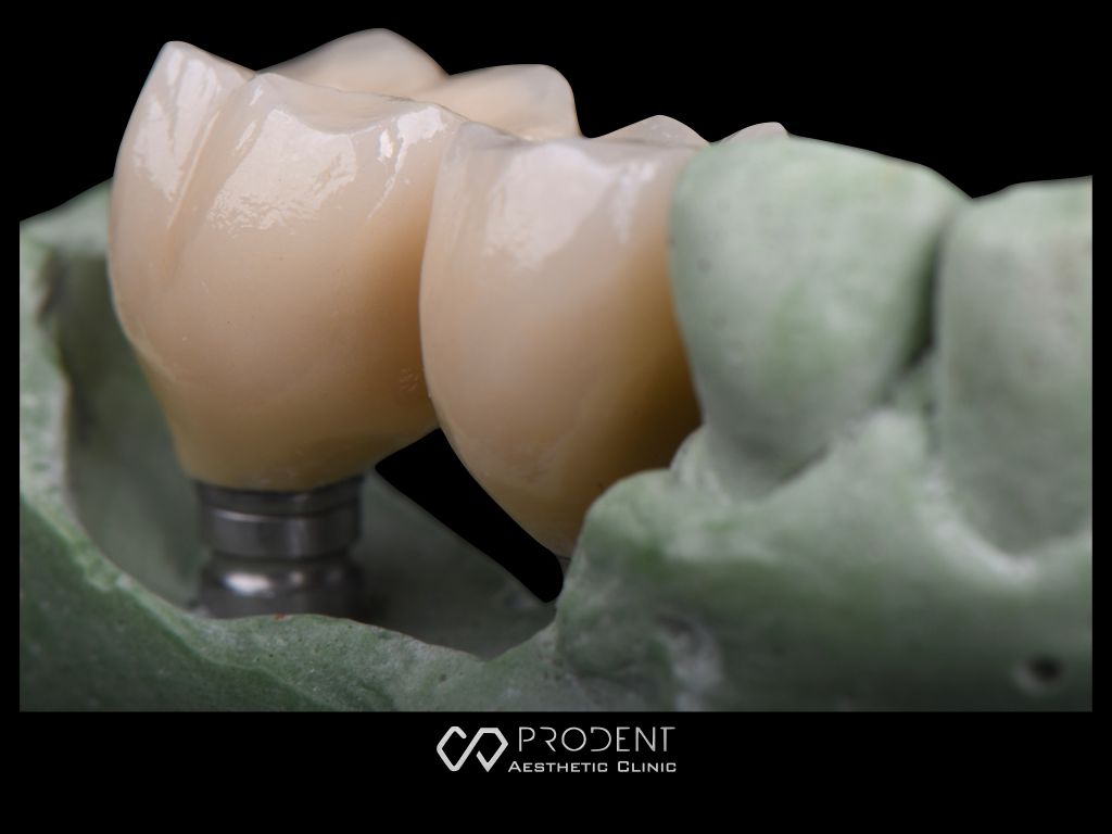 Ramiro Ivan Pérez Murillo-47