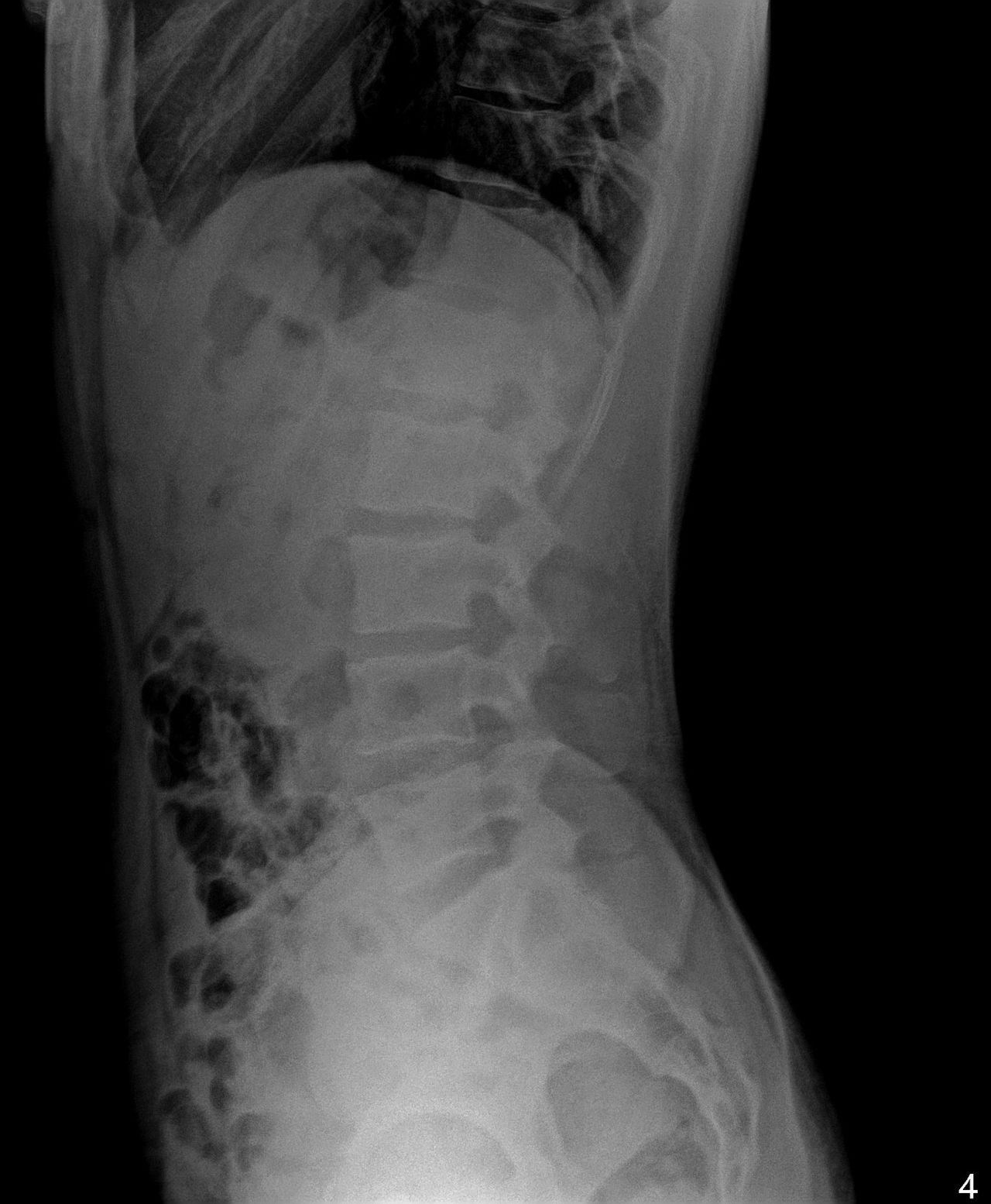 Samuel Garza Pacheco -5