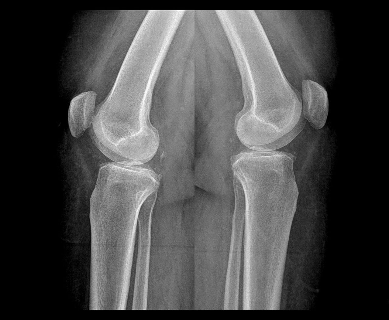 Samuel Garza Pacheco -1