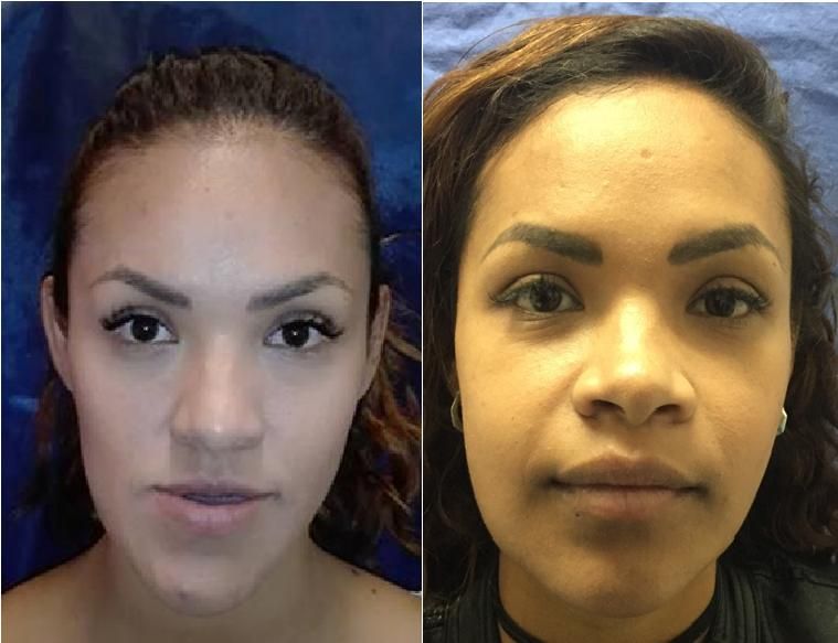 Alberto Wintergerst Fisch-37