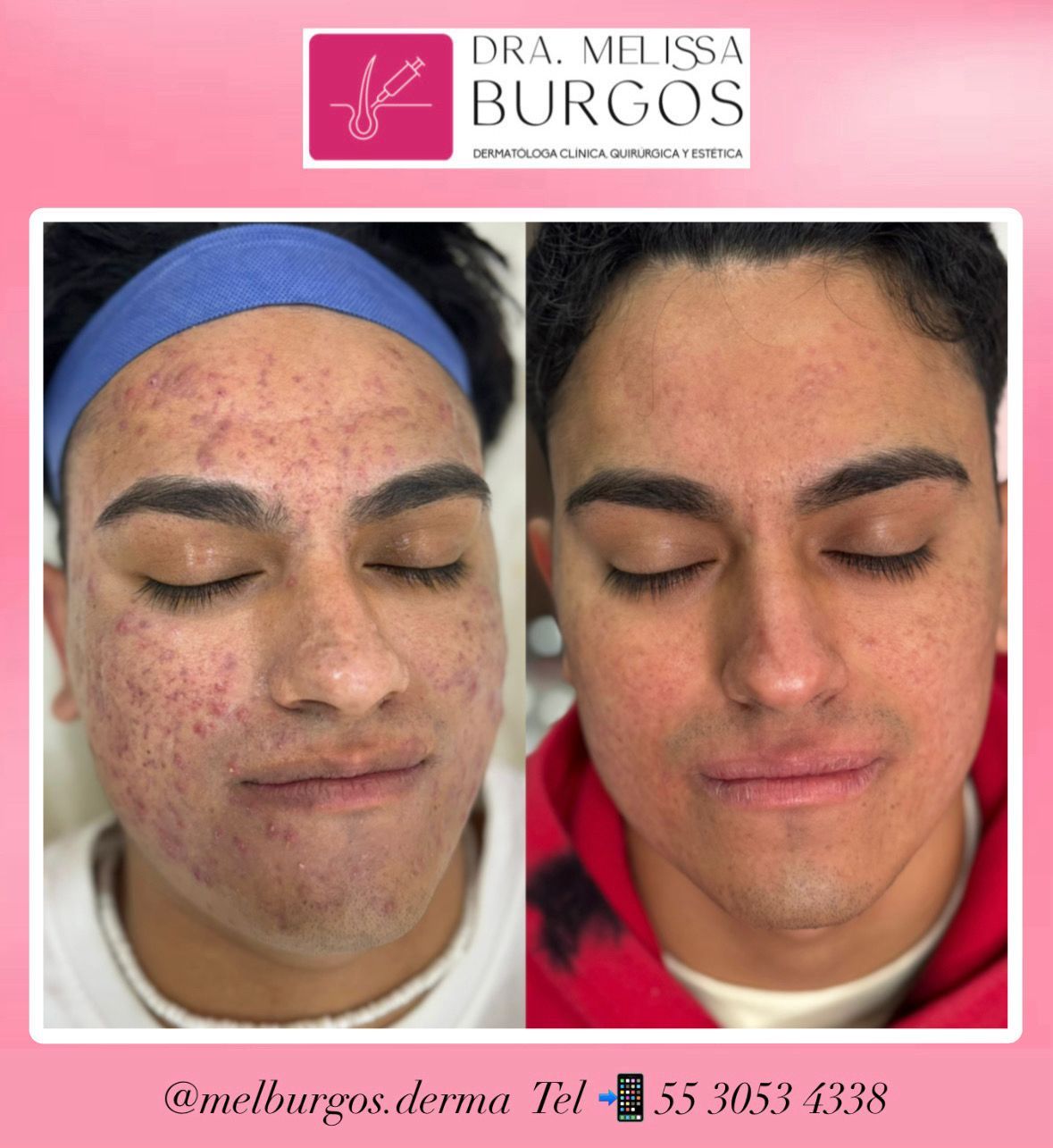 Melissa Burgos Romero-0