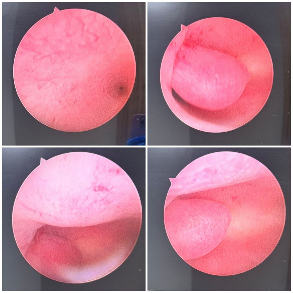 Juan Coronado Lima-0