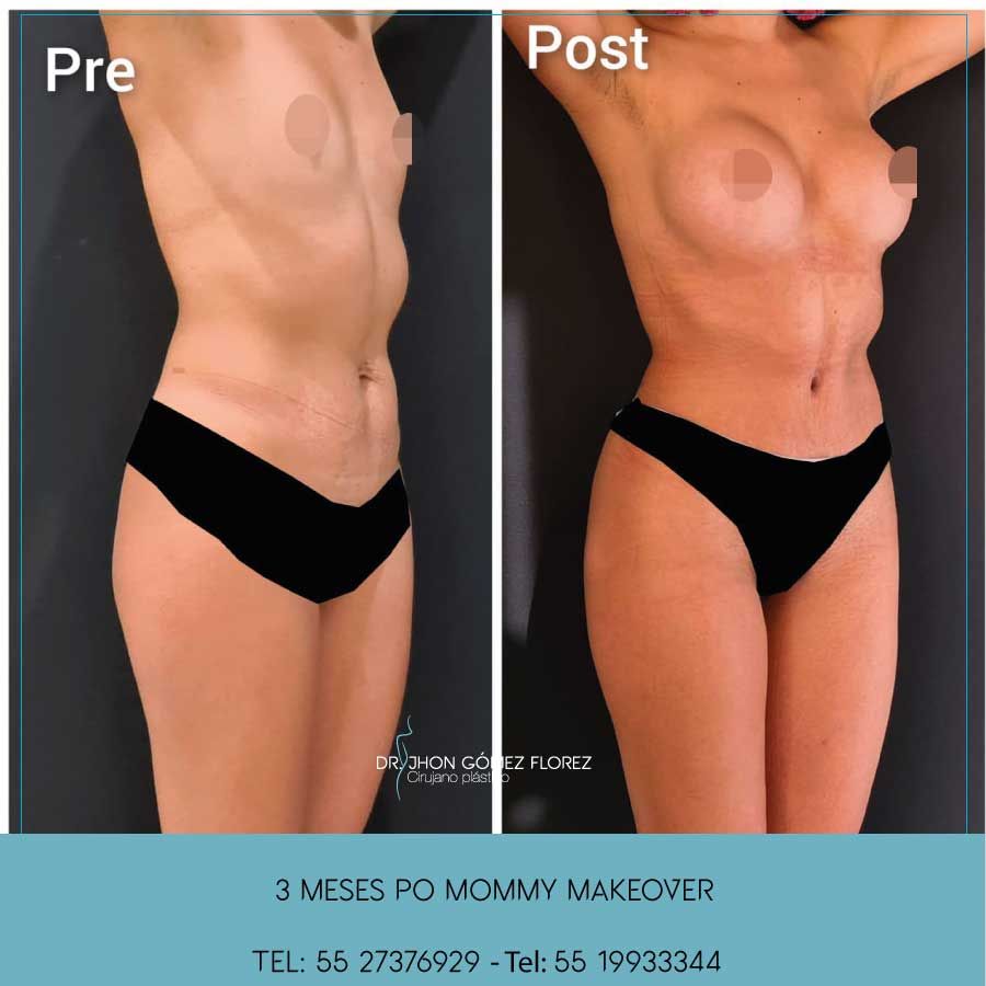 Jhon César Gómez Florez-11