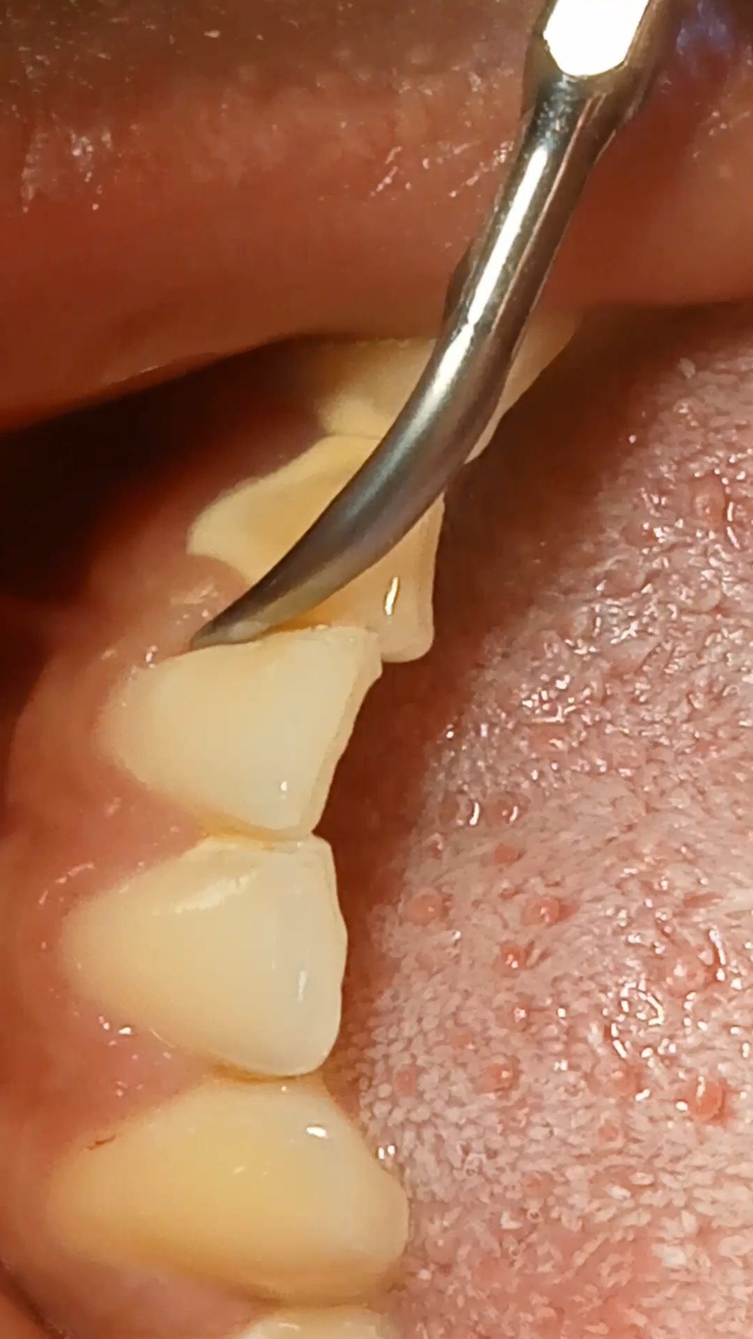 Jose David Torres Hernandez-5