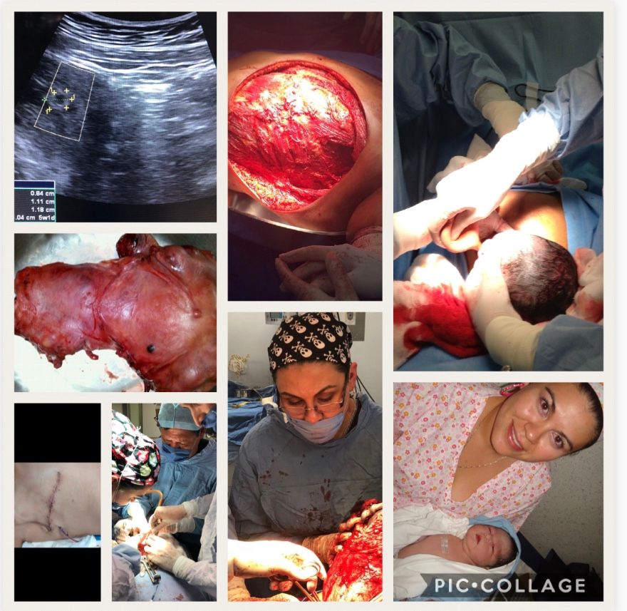 Brenda Anaid Torres Ugalde-6