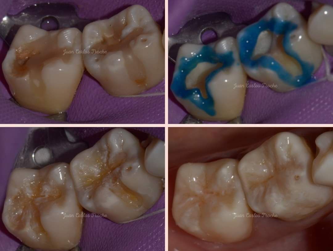 Juan Carlos Troche Chavez-6