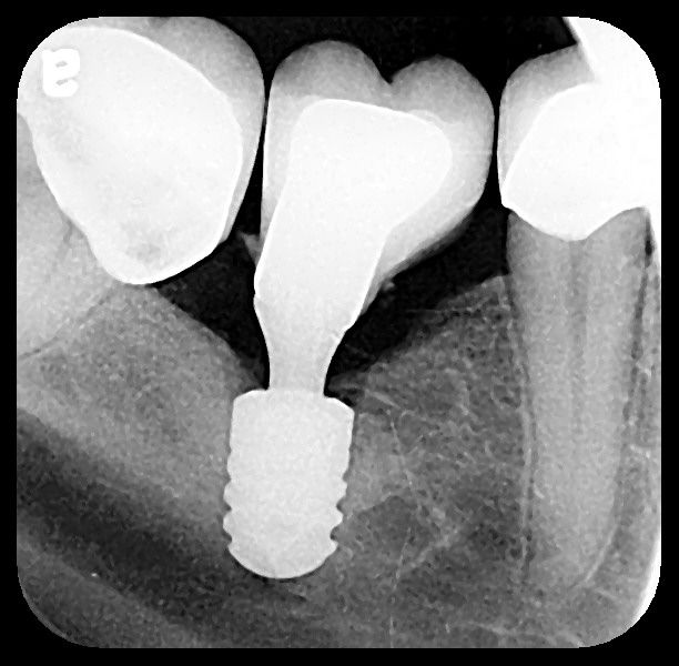 Enrique Espinosa Castellanos-6