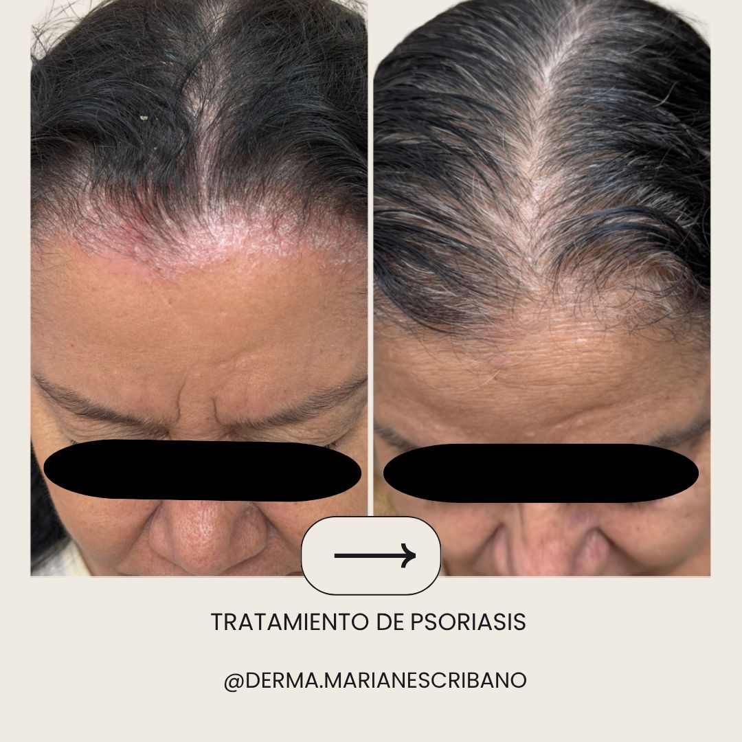 Marian Escribano Ponce-9