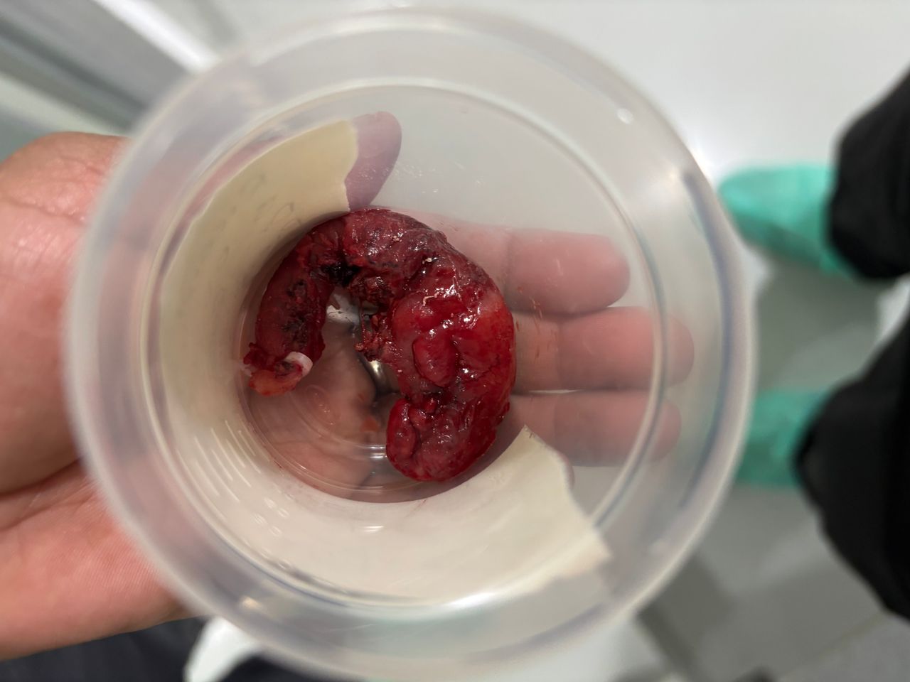 Edgar Raziel Acosta May-7