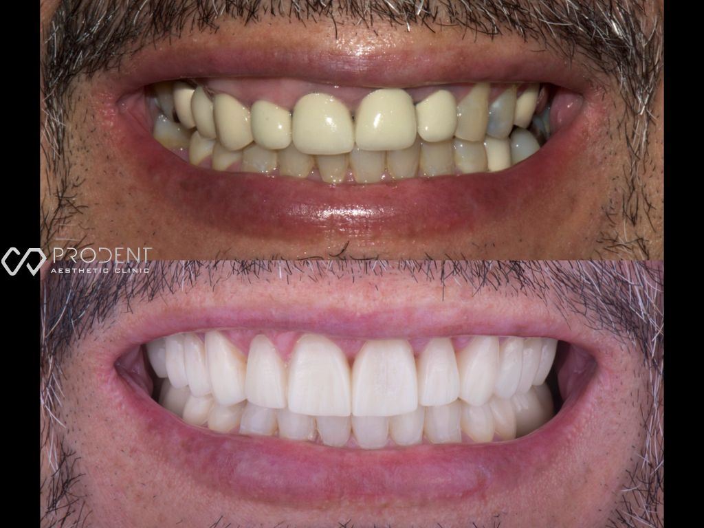 Ulises Pérez Murillo-59