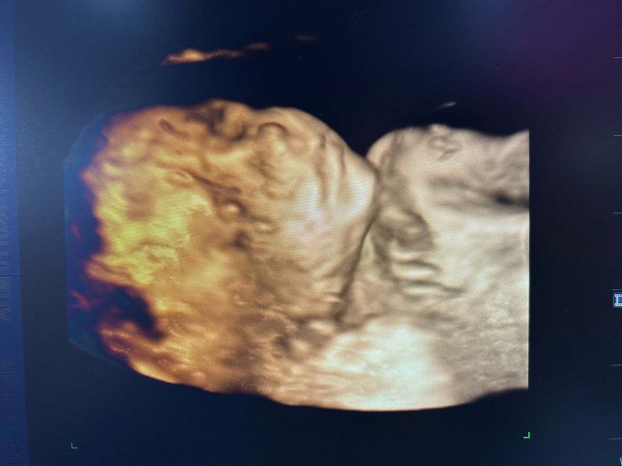 Armando Cinta Luna-3