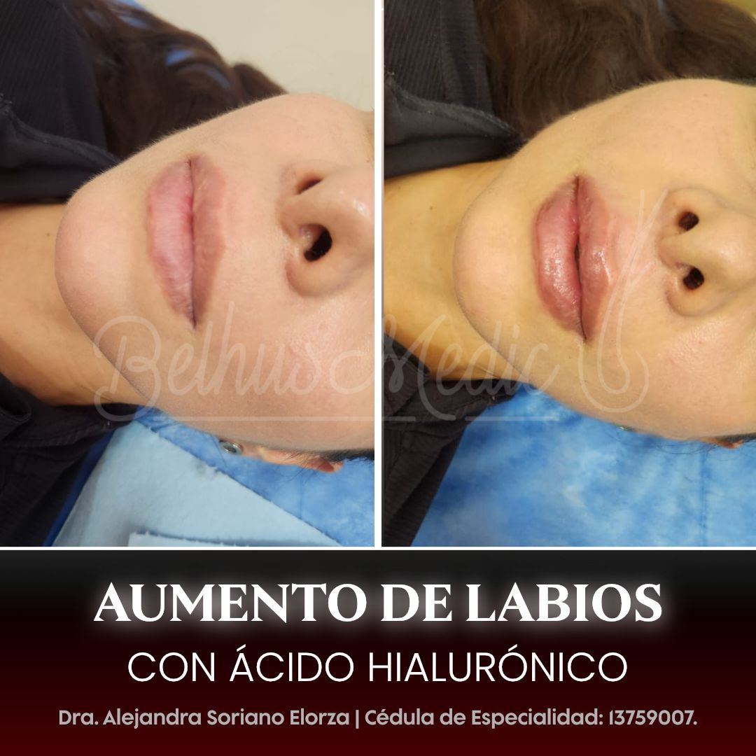 Alejandra Soriano Elorza-79