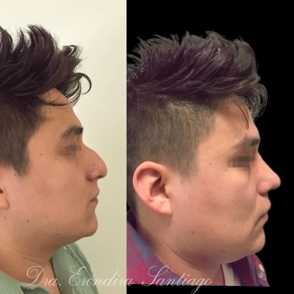 Erendira Santiago Santiesteban-6