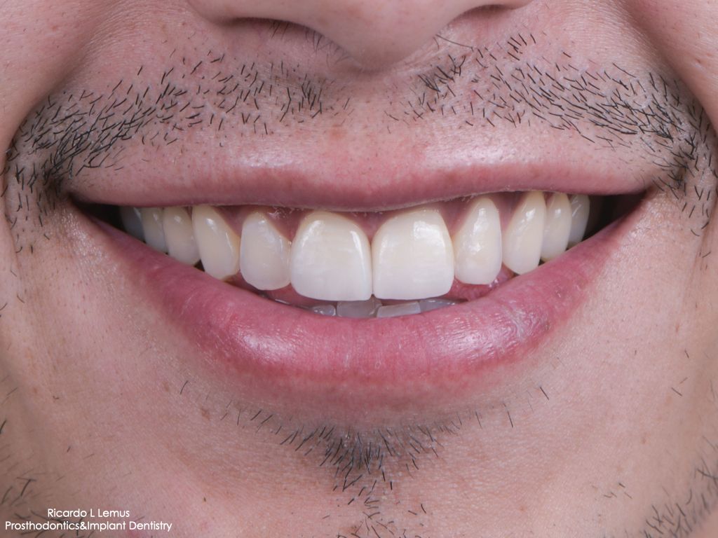 Ricardo López Lemus-122