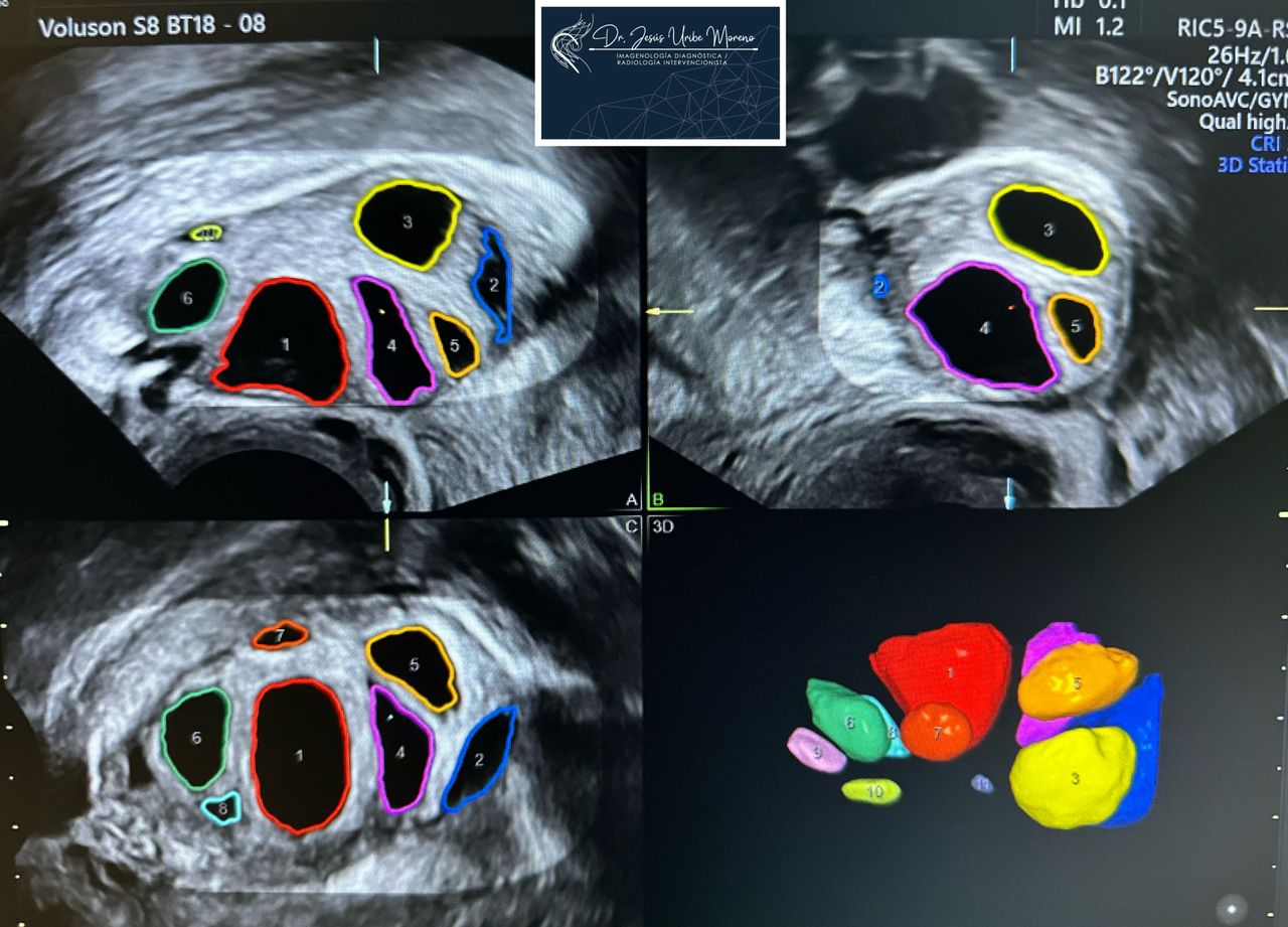 Jesus Uribe Moreno-5