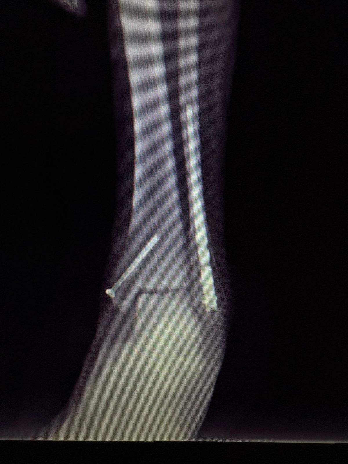 Humberto Antonio Hernández Gómez-8