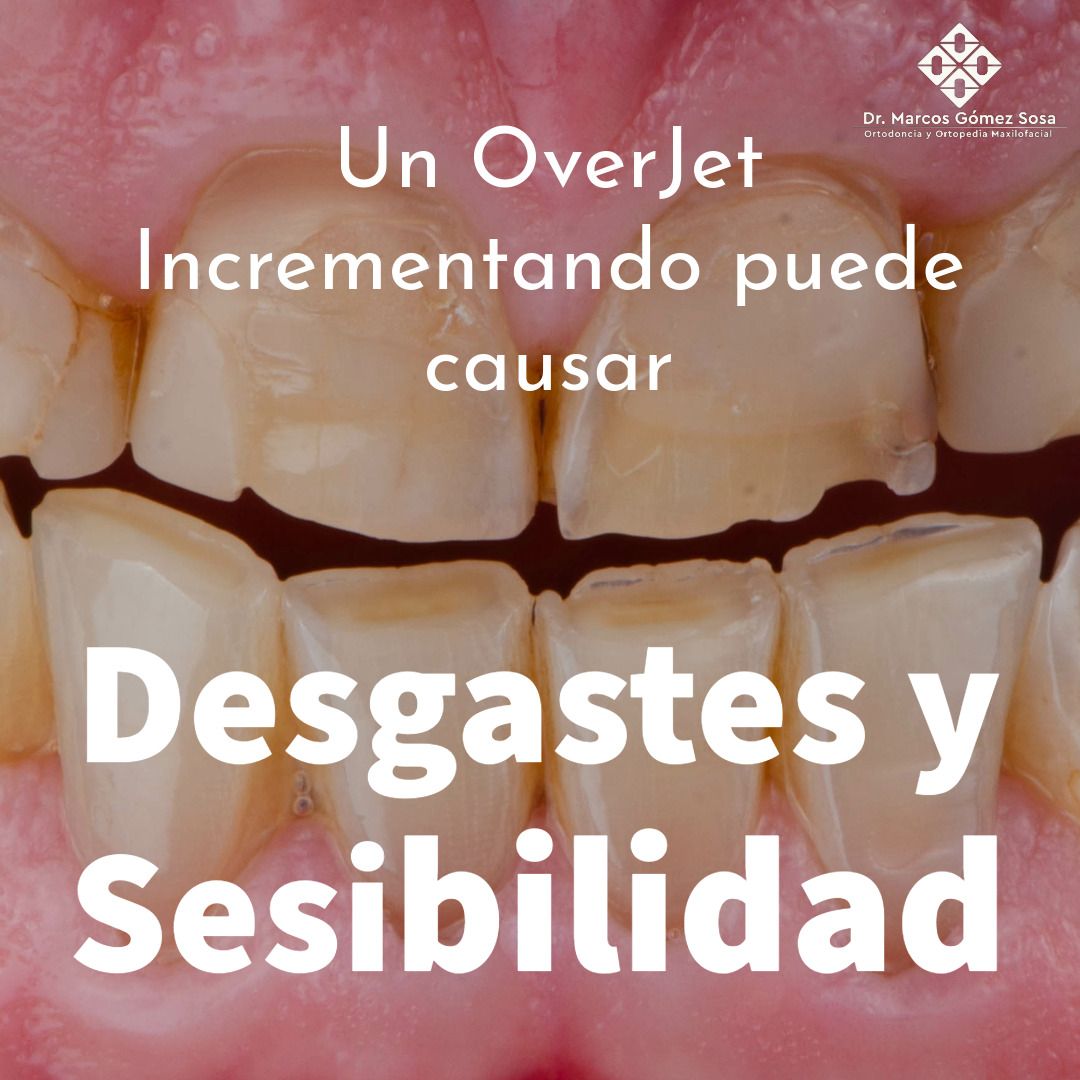 Marcos Gómez Sosa-35