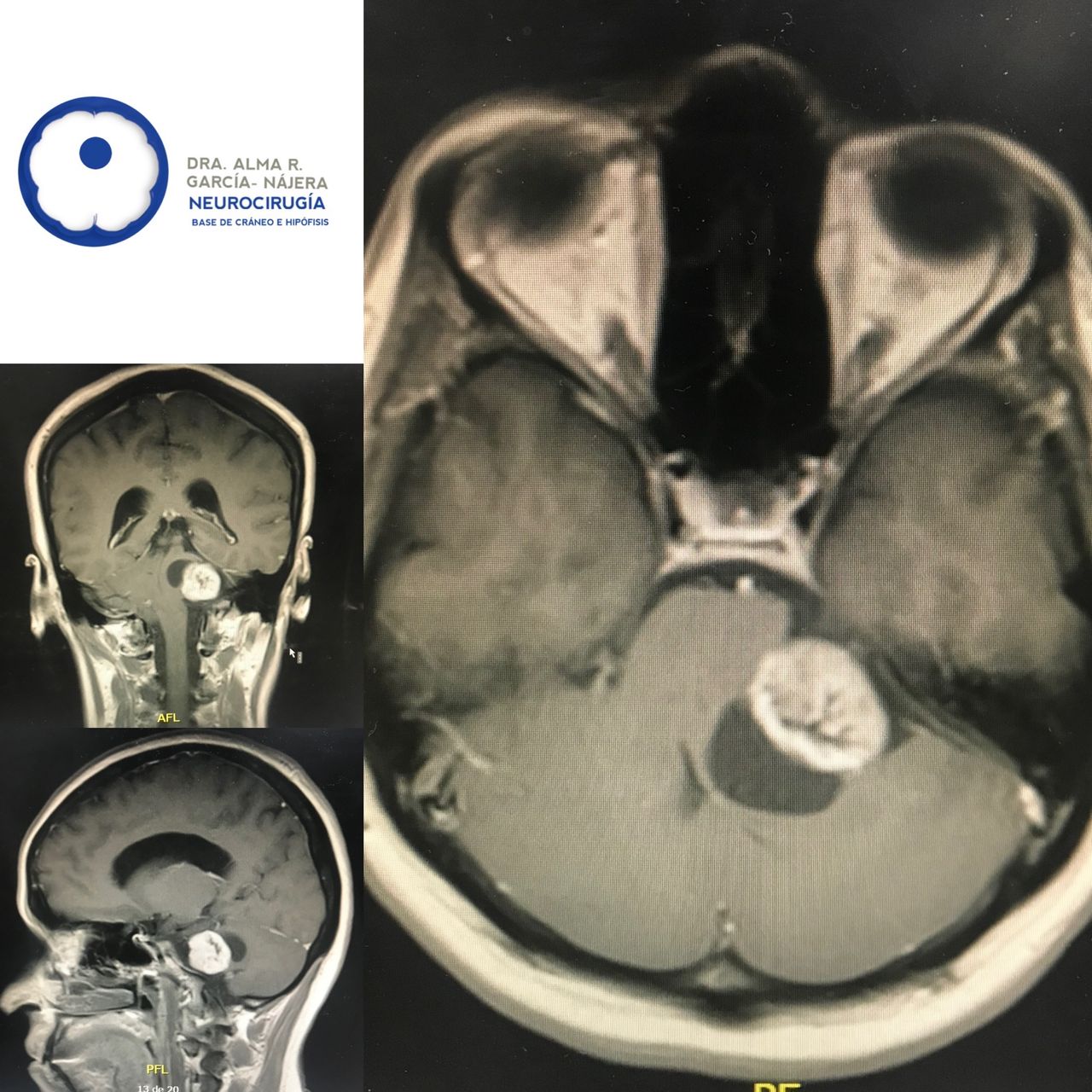 Alma García Nájera-11