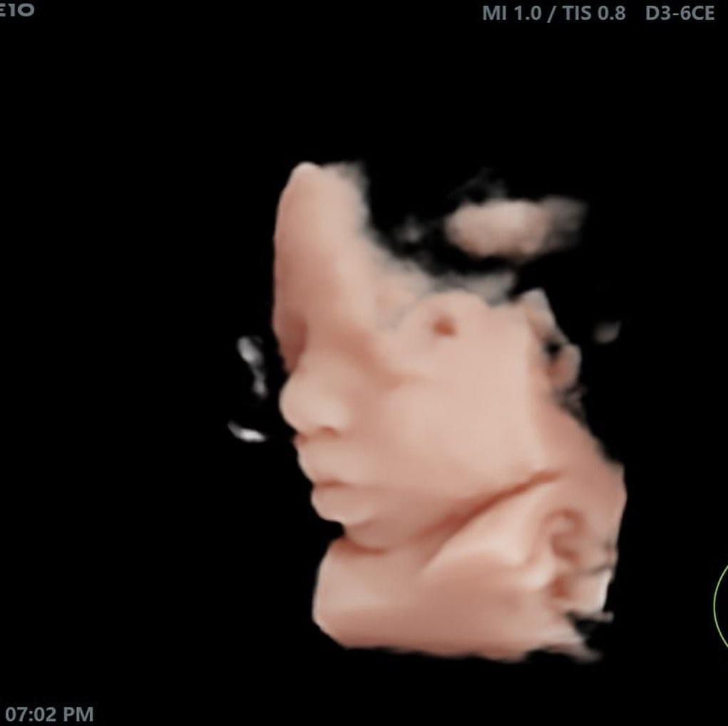 Miguel Eduardo Guigón Canseco-2