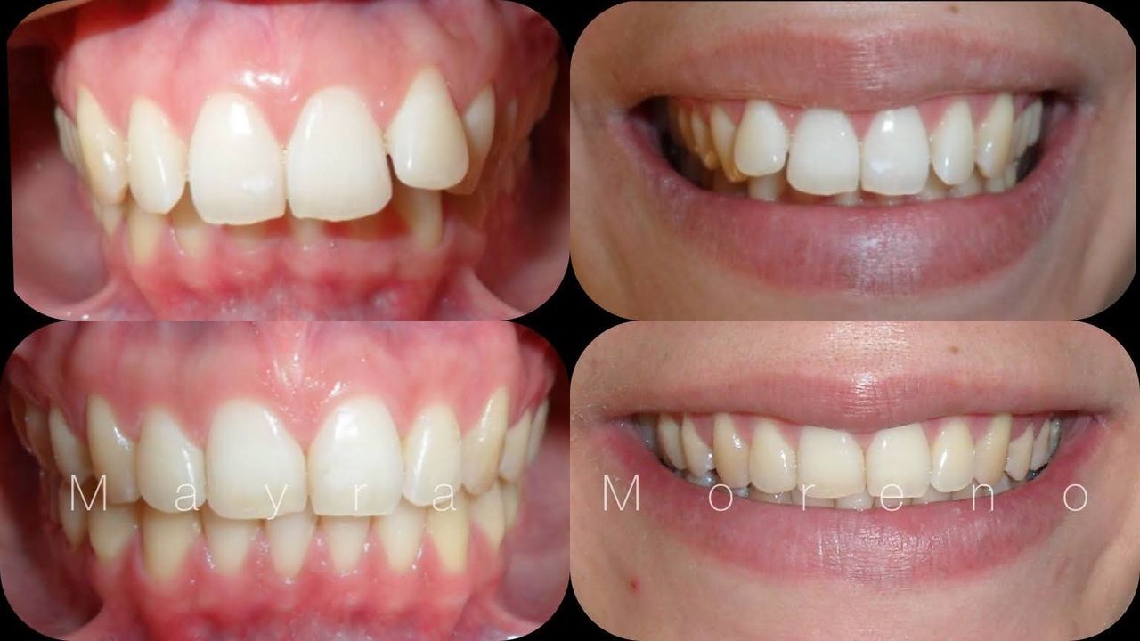 Mayra Moreno Rojas-5