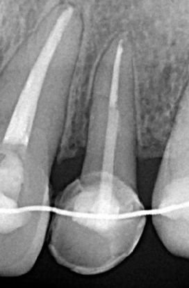 Esmeralda Candida Guerrero Pimentel-39