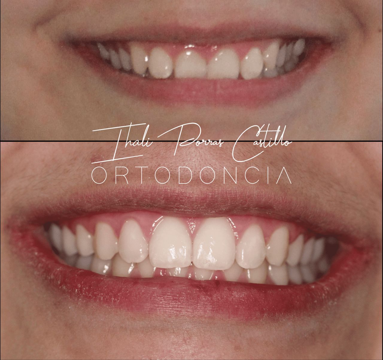 Ihali Porras Castillo-11