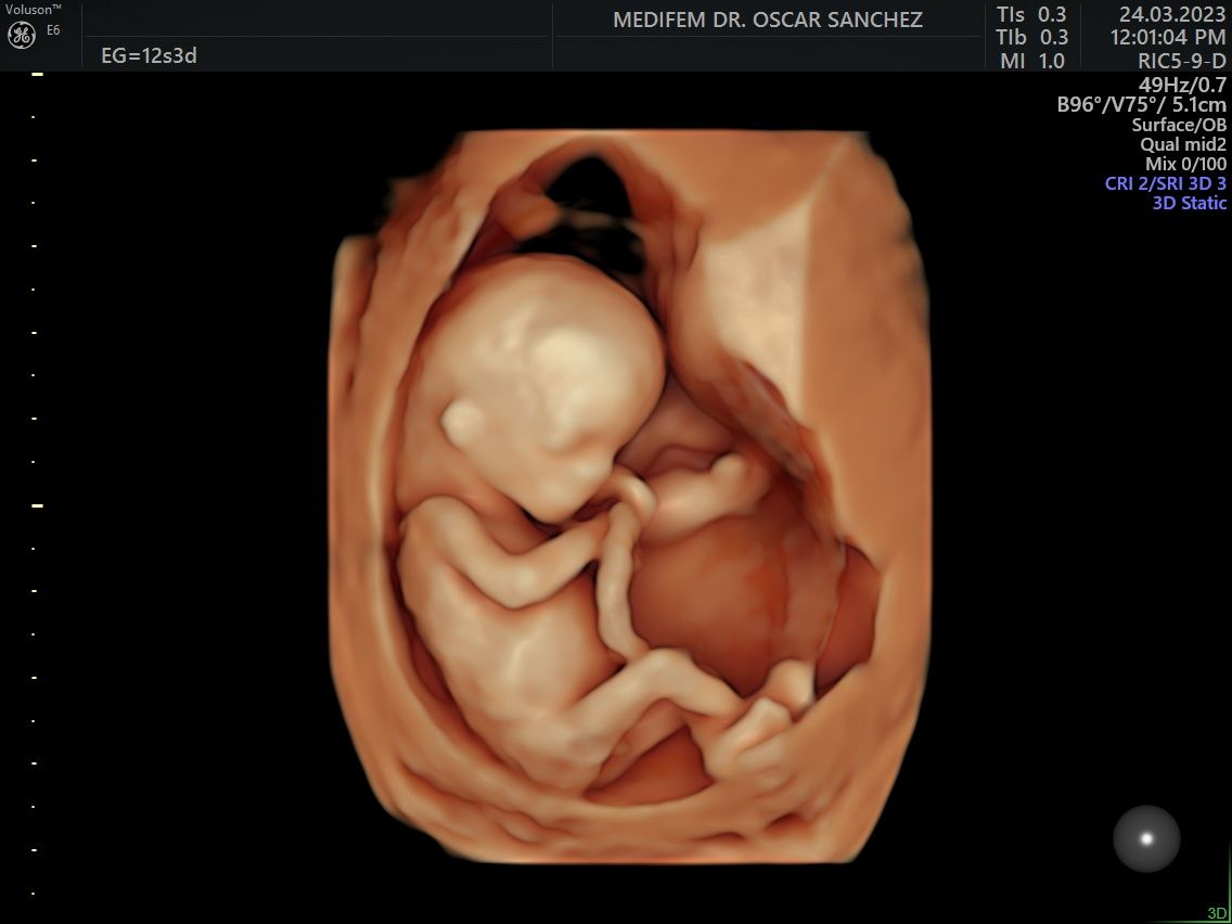 Oscar Alejandro Sánchez Gámez-18