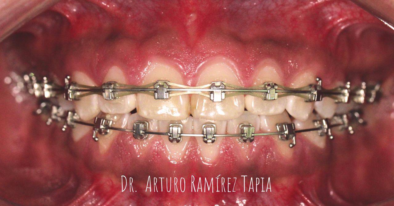 Arturo Ramírez Tapia-9