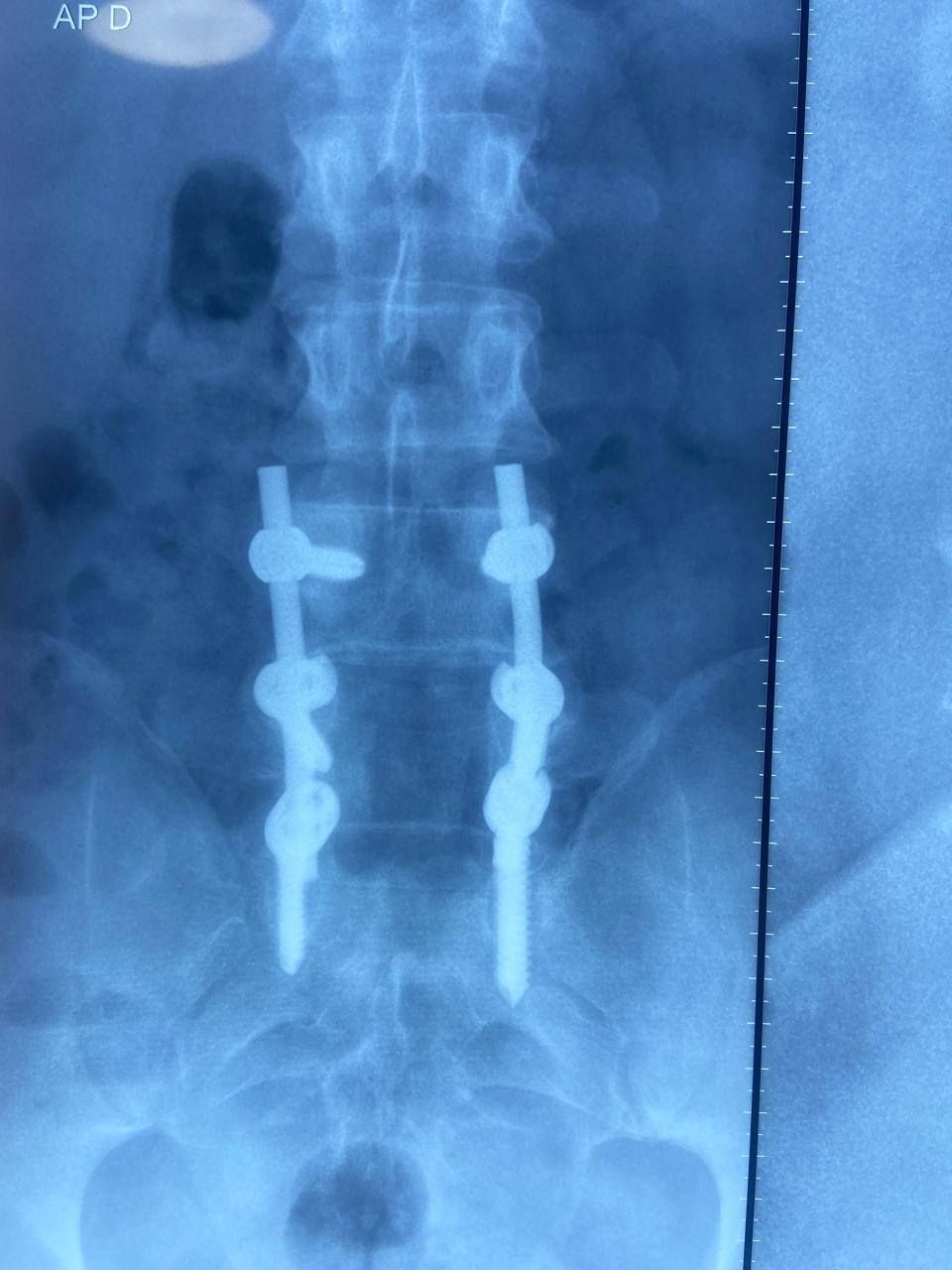 Víctor Alberto García García-3