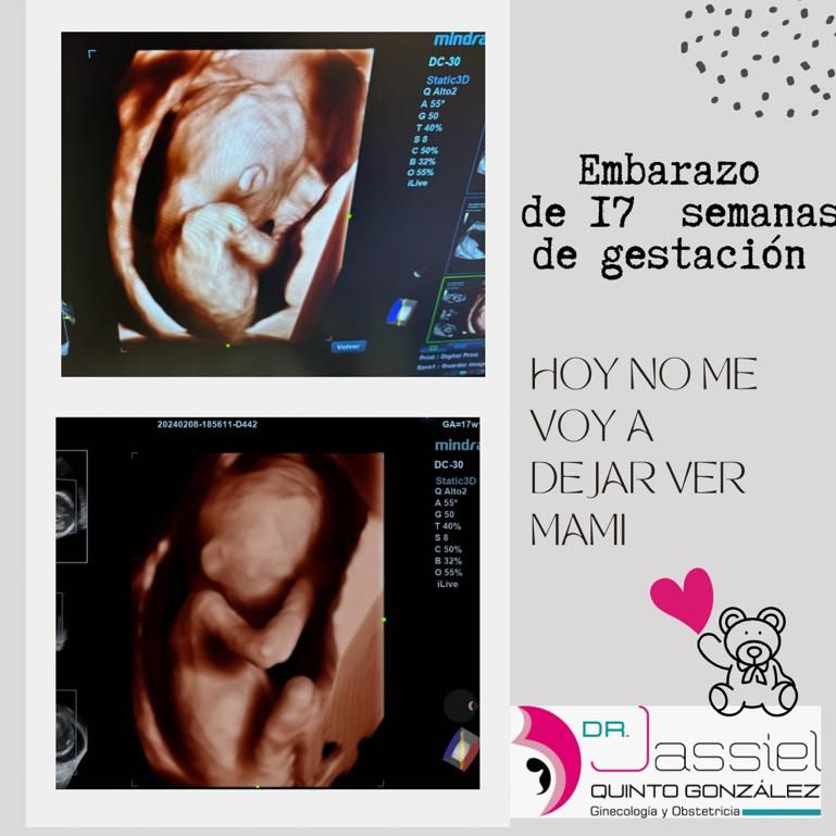 Jose Jassiel Quinto Gonzalez-1