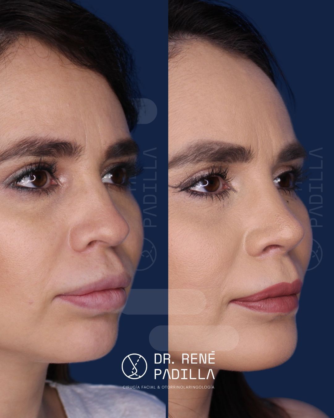 René E. Padilla López-30