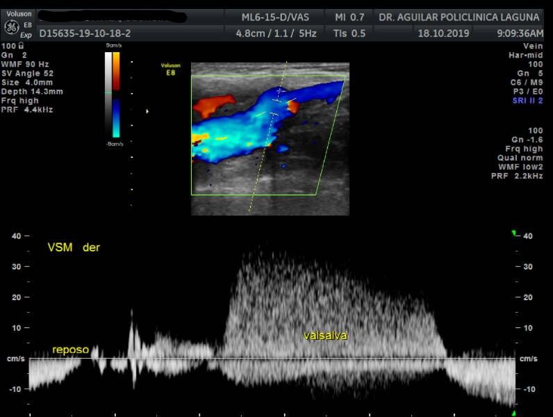 Edgar Fernando Aguilar Morales-13