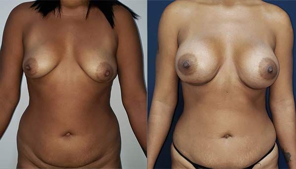 Edgar Ernesto Torres Mejía-17