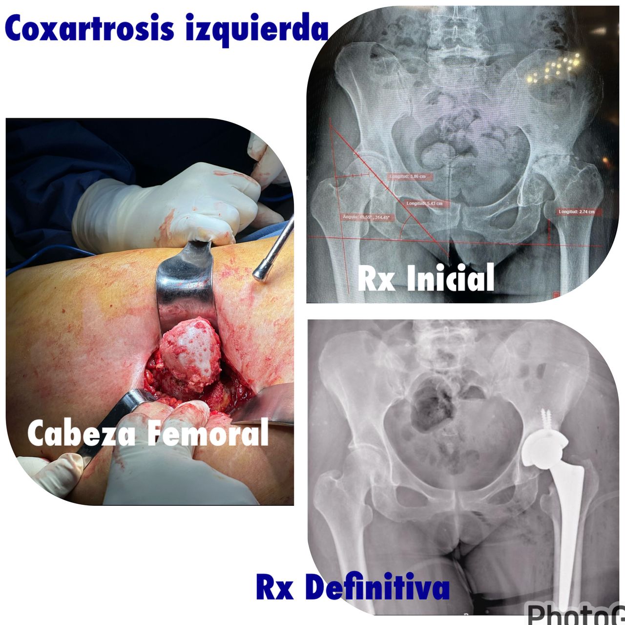 Carlos Tapia Hernández-11