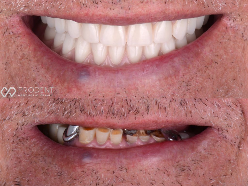 Ulises Pérez Murillo-93