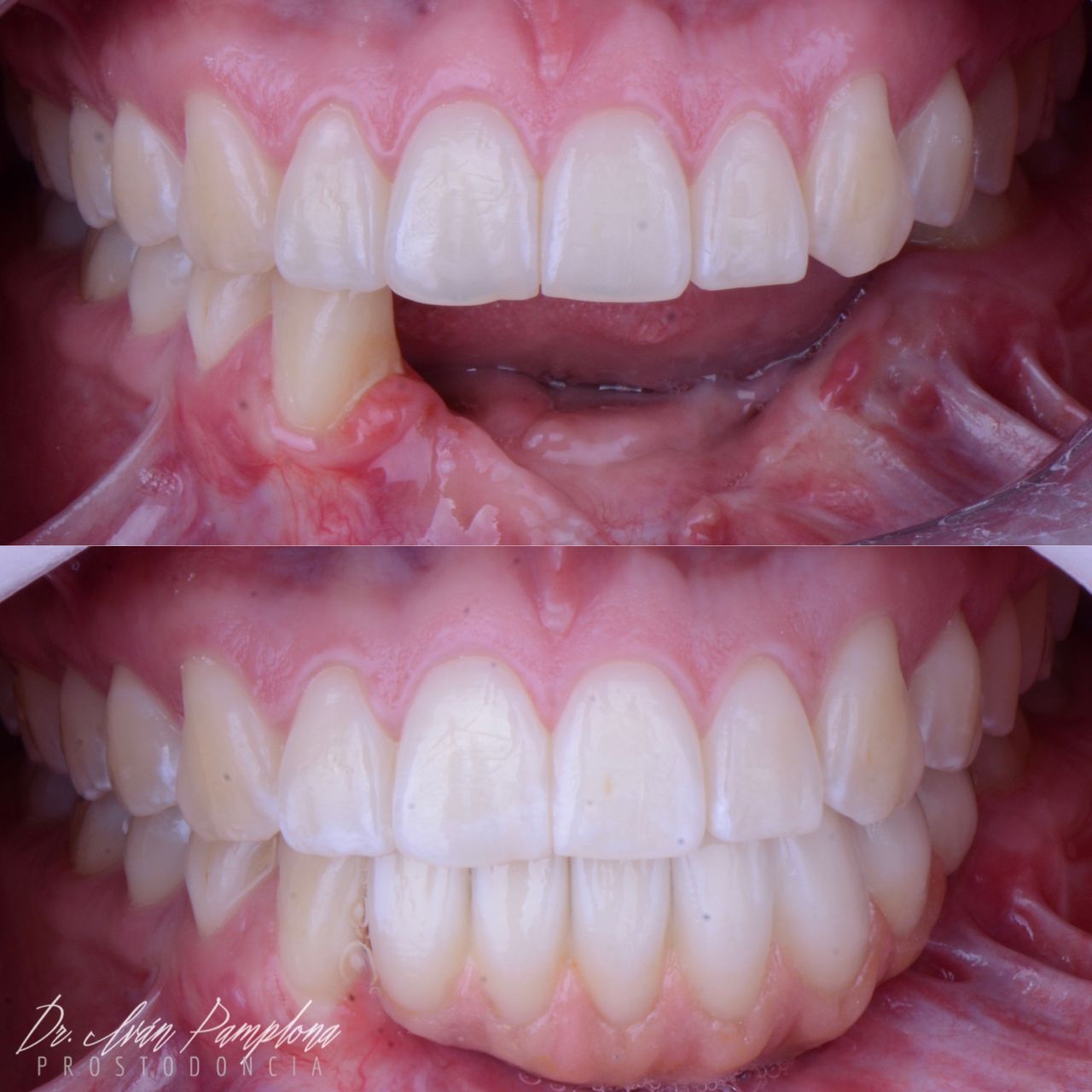 Iván Gerardo Pamplona Alfaro-23