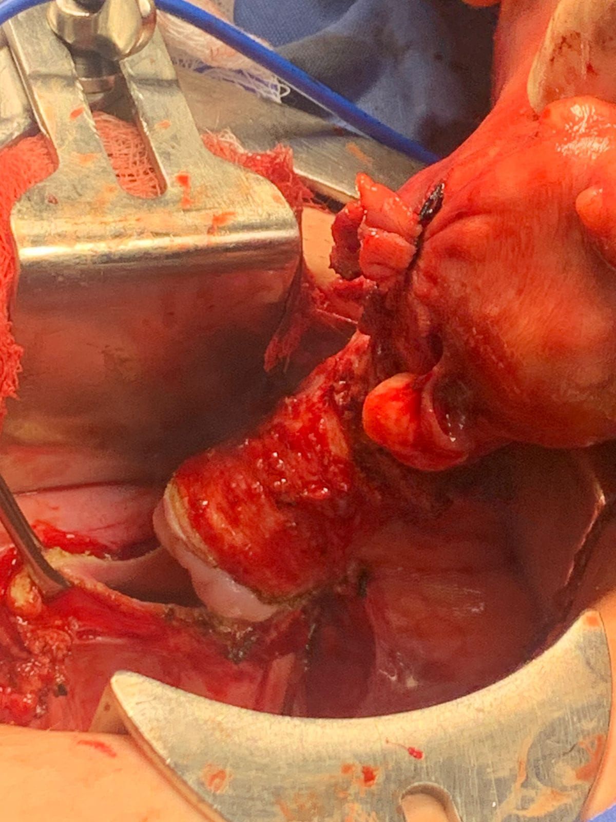 Abraham Ignacio Pérez De La Rosa-17