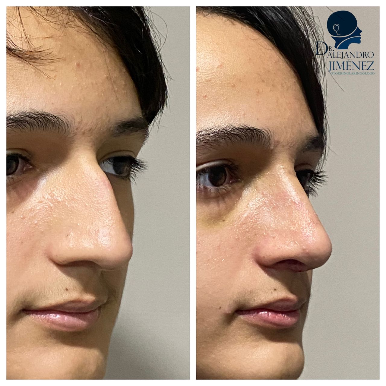 Alejandro Jimenez Garcia-28