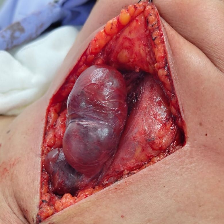 Jose Abraham Sauceda Ramirez-4