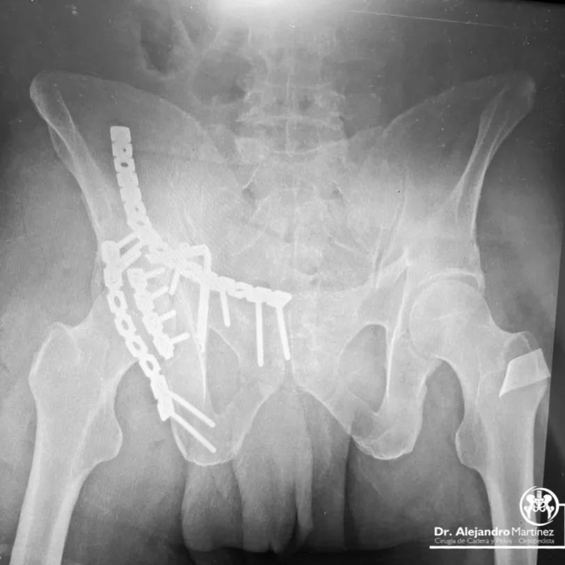 Alejandro Martínez Ramírez-0