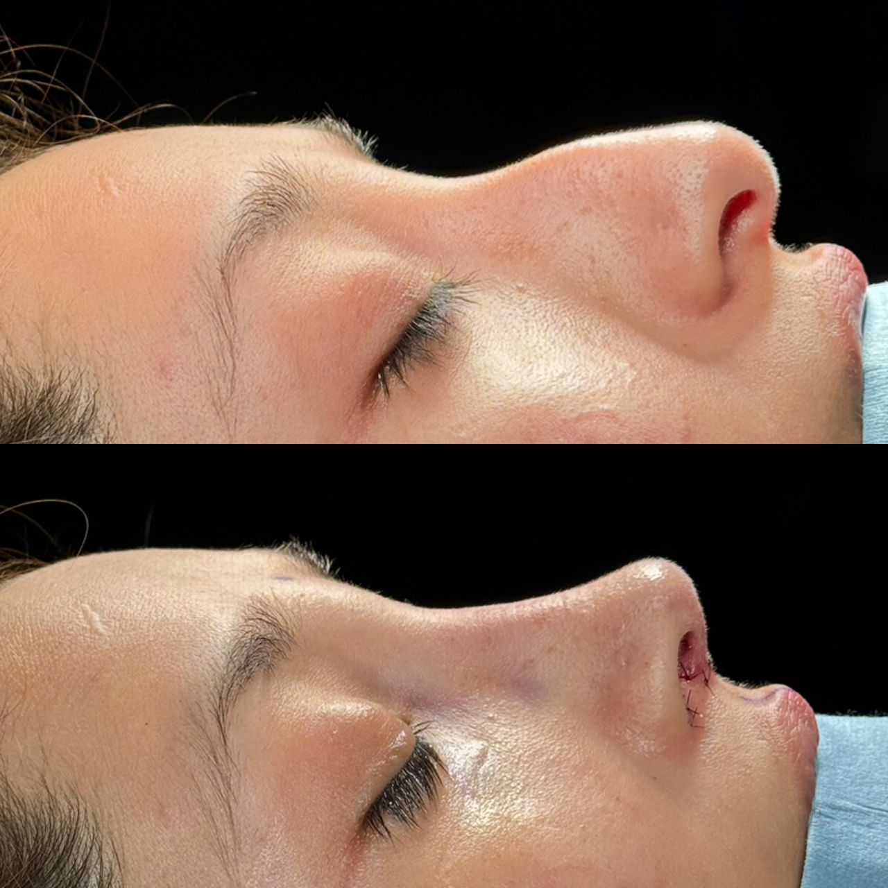 Angel Castro Urquizo-3