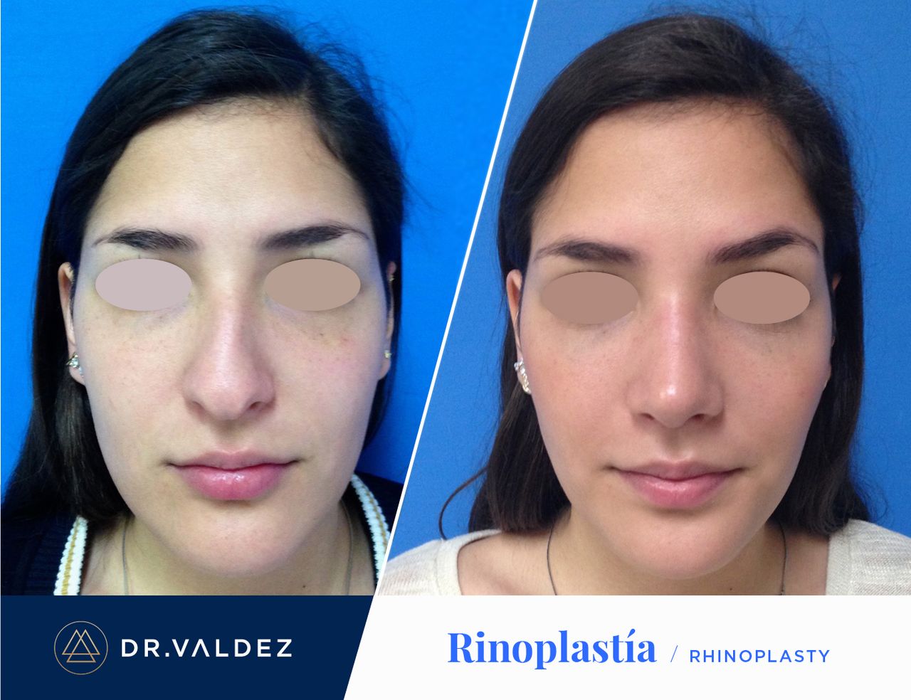 Pedro Arturo Valdez Gomez-11